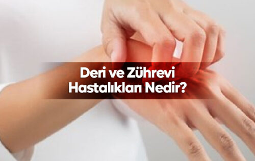 Deri ve Zührevi Hastalıkları Nedir