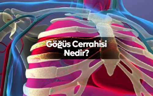 Göğüs Cerrahisi Nedir