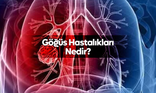 Göğüs Hastalıkları Nedir