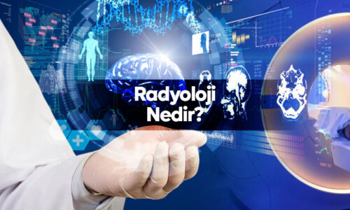 Radyoloji Nedir